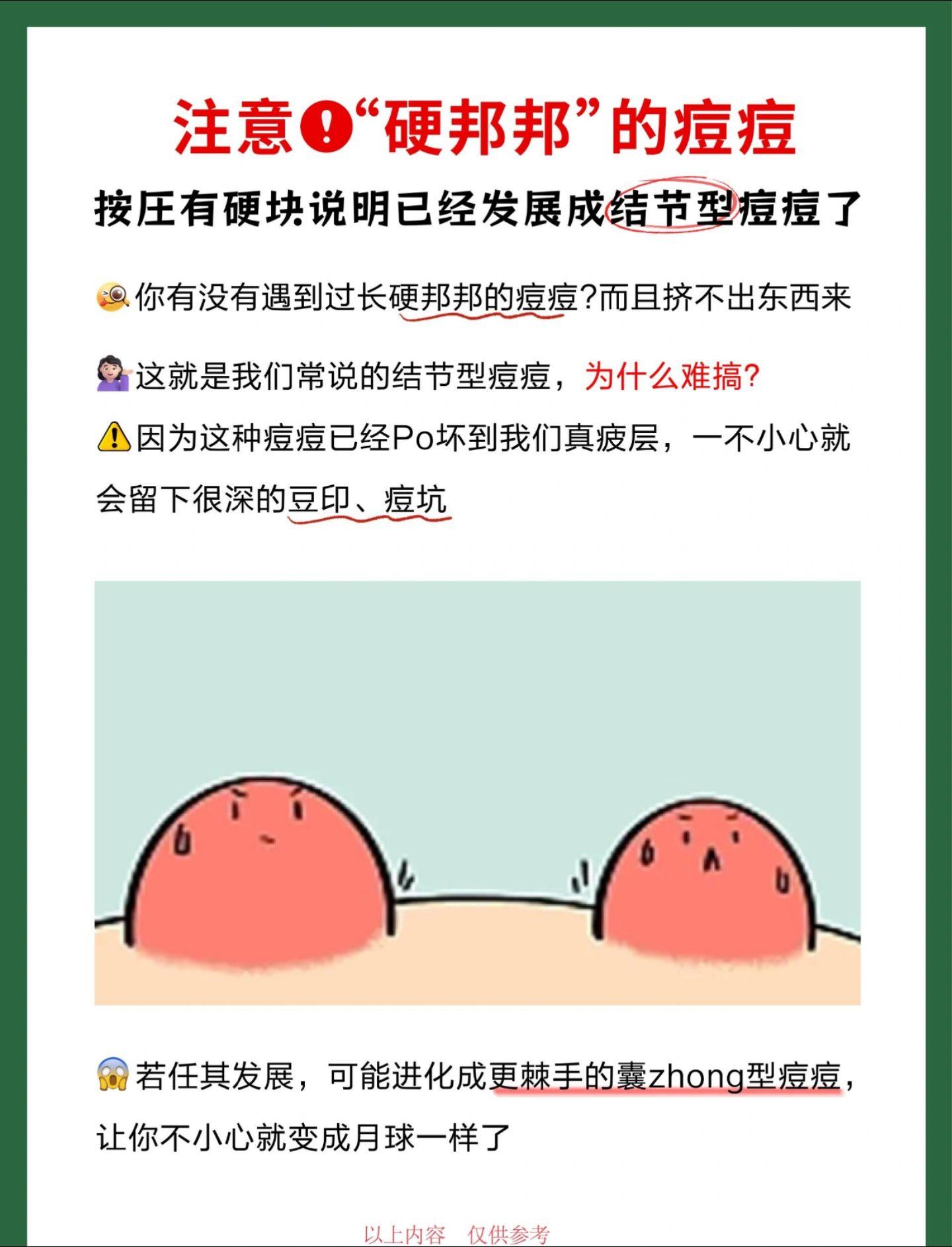 硬邦邦的痘痘怎么办?结节与囊肿的区别。囊肿结节痘痘怎么处理