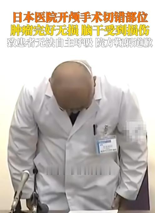 一台开颅手术，病灶完好无损，被切掉的竟是健康脑组织，脑干还受了伤。


8月7日