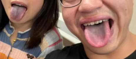 “这事真说不清！”重庆一男子请三位朋友吃火锅，花了2000多，餐后4人舌苔发黑，