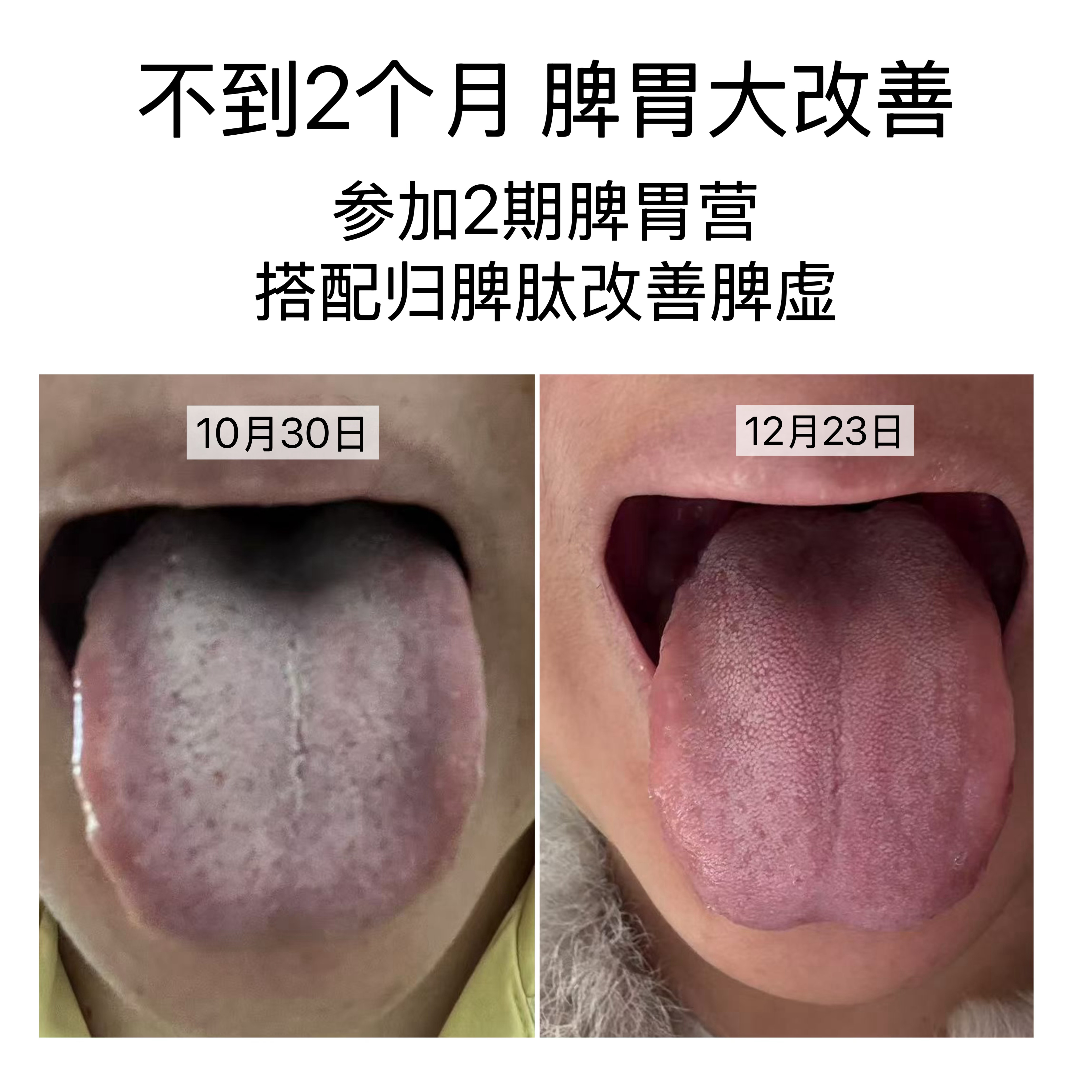 经常有姐妹在我微博评论区说，脾胃好难调理啊🌿我想说，你一定没有按照菲菲姐说的方