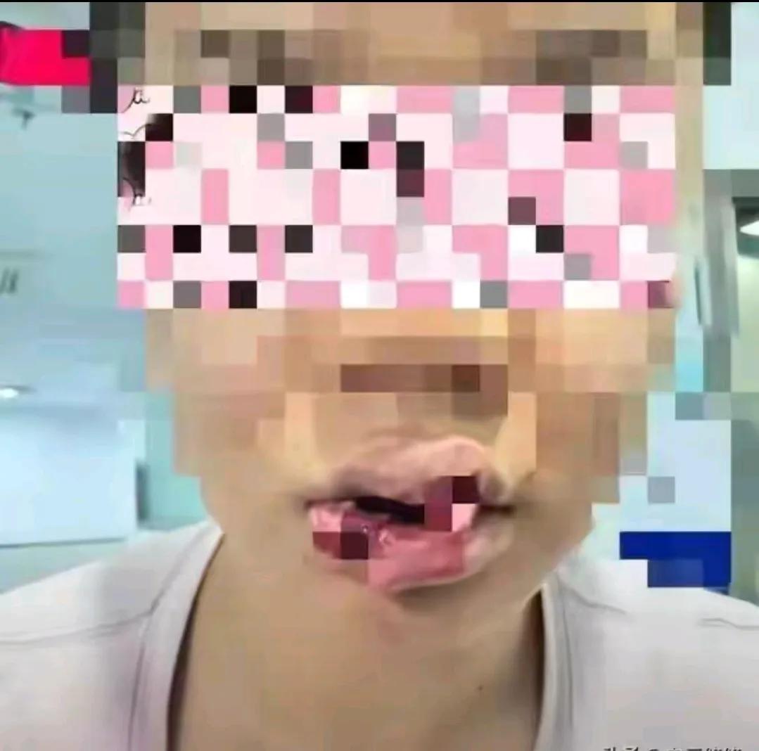 为了和狗亲个嘴就变成这样了，值得吗？
养狗人啊，最不能让人理解的就是他认为狗真的