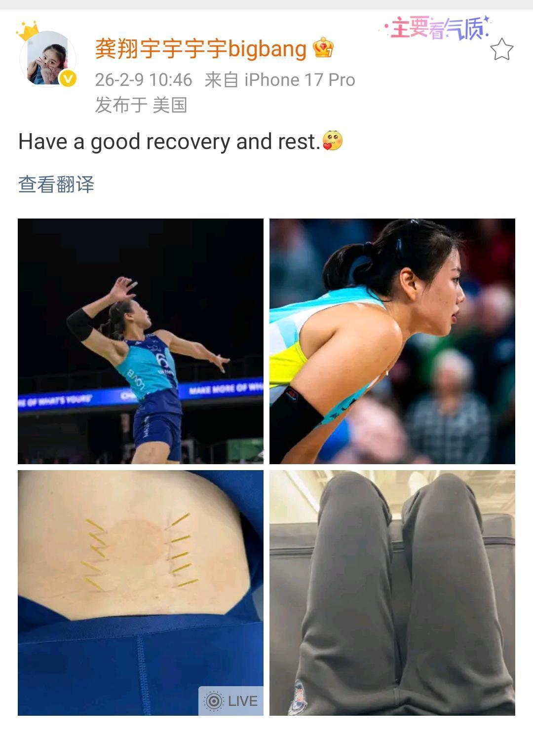 龚翔宇晒照报平安，缺阵龚翔宇的麦迪逊队已遭六连败
 
北京时间2月9日上午10时