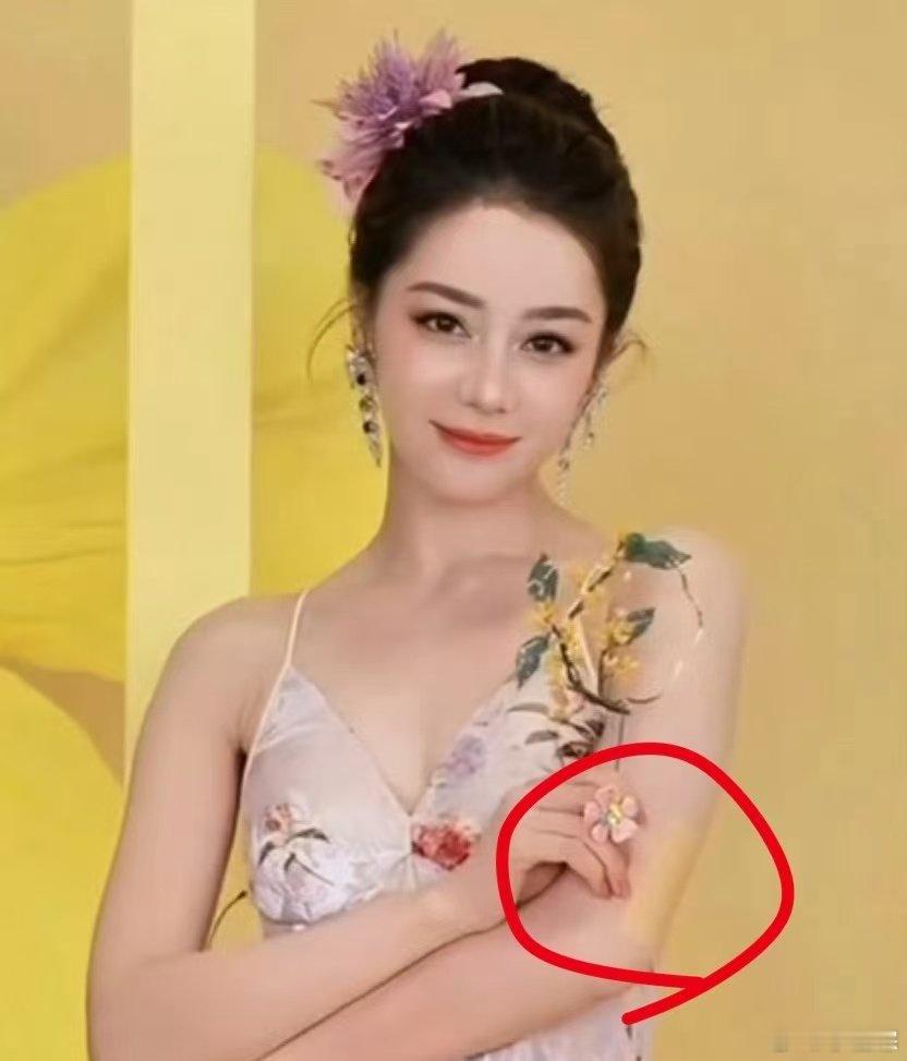 迪丽热巴胳膊上贴了膏药迪丽热巴胳膊上贴了膏药！迪丽热巴手臂上贴了膏药 ​​​