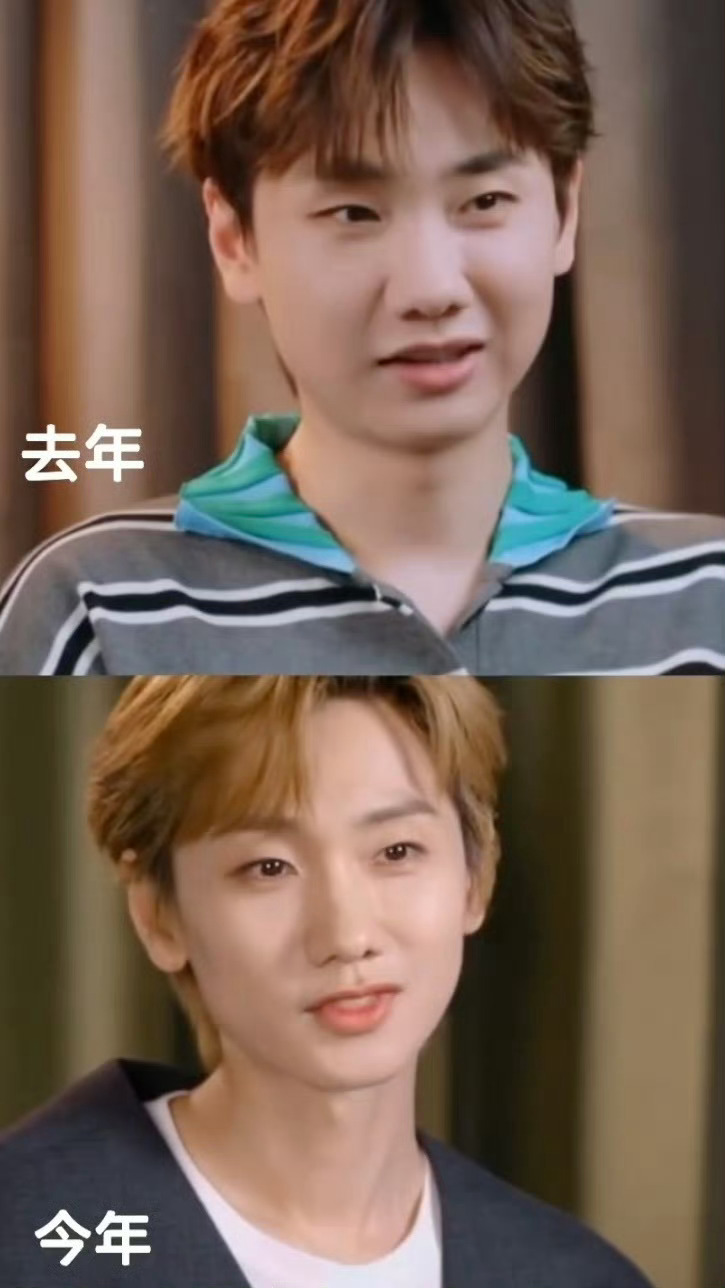 男的也一样，人瘦下来之后法令纹都没了。。。 ​ ​​​