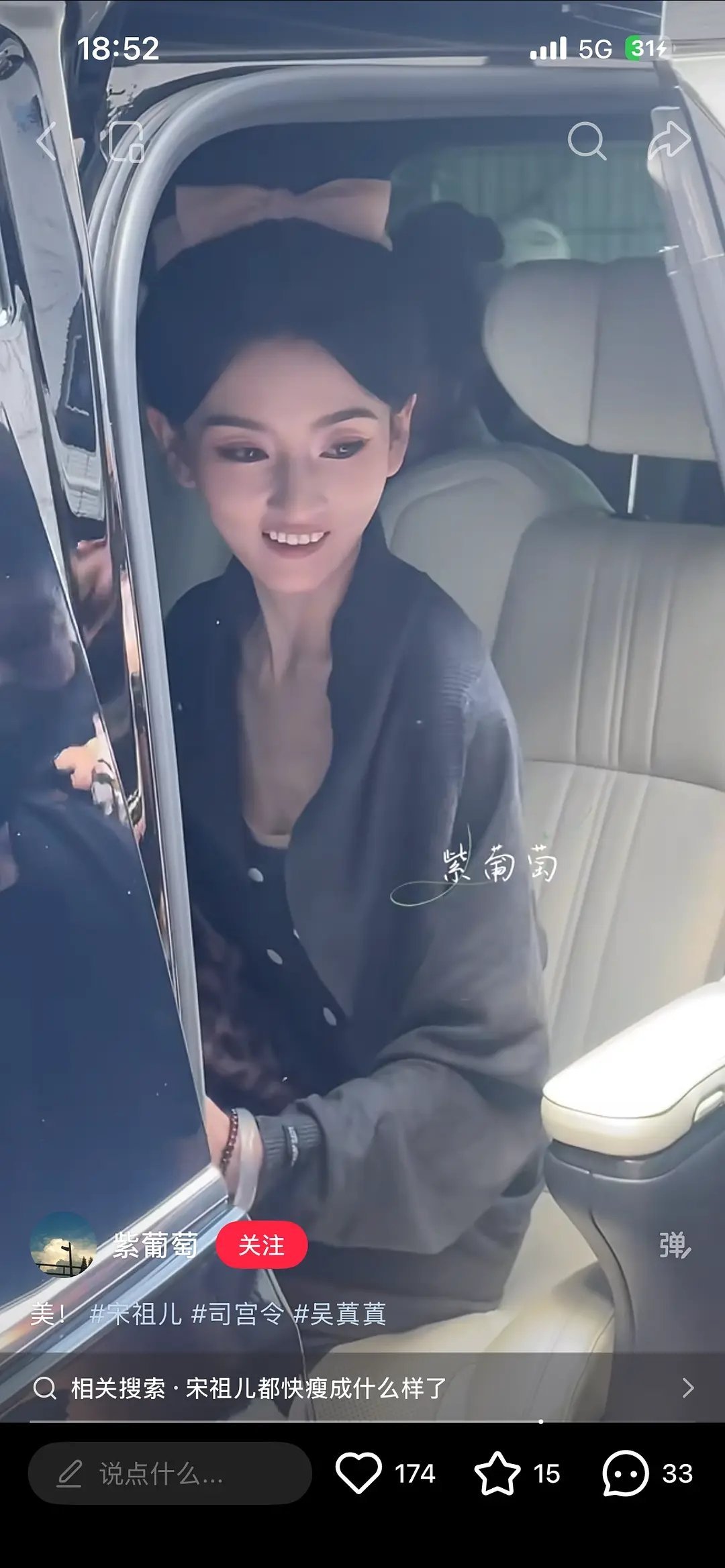 瘦成这样。。。我的天。。。感觉每一次见到宋祖儿都能瘦出新高度。。。她身边没人告诉