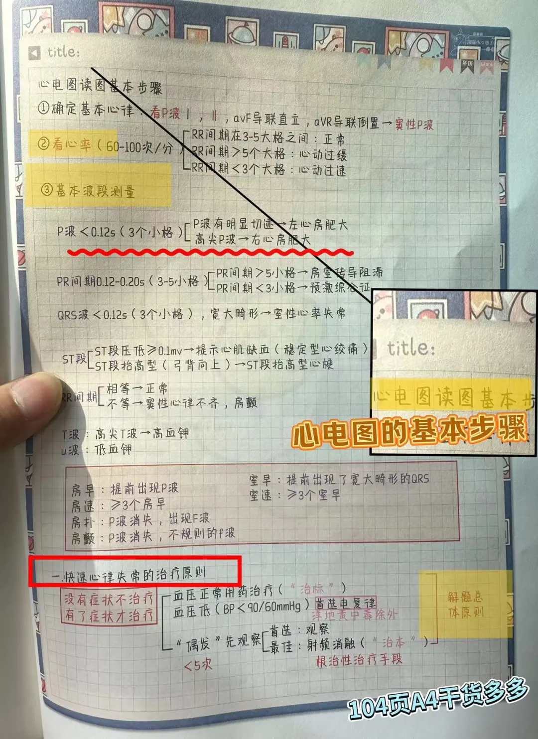 心电图实战步骤