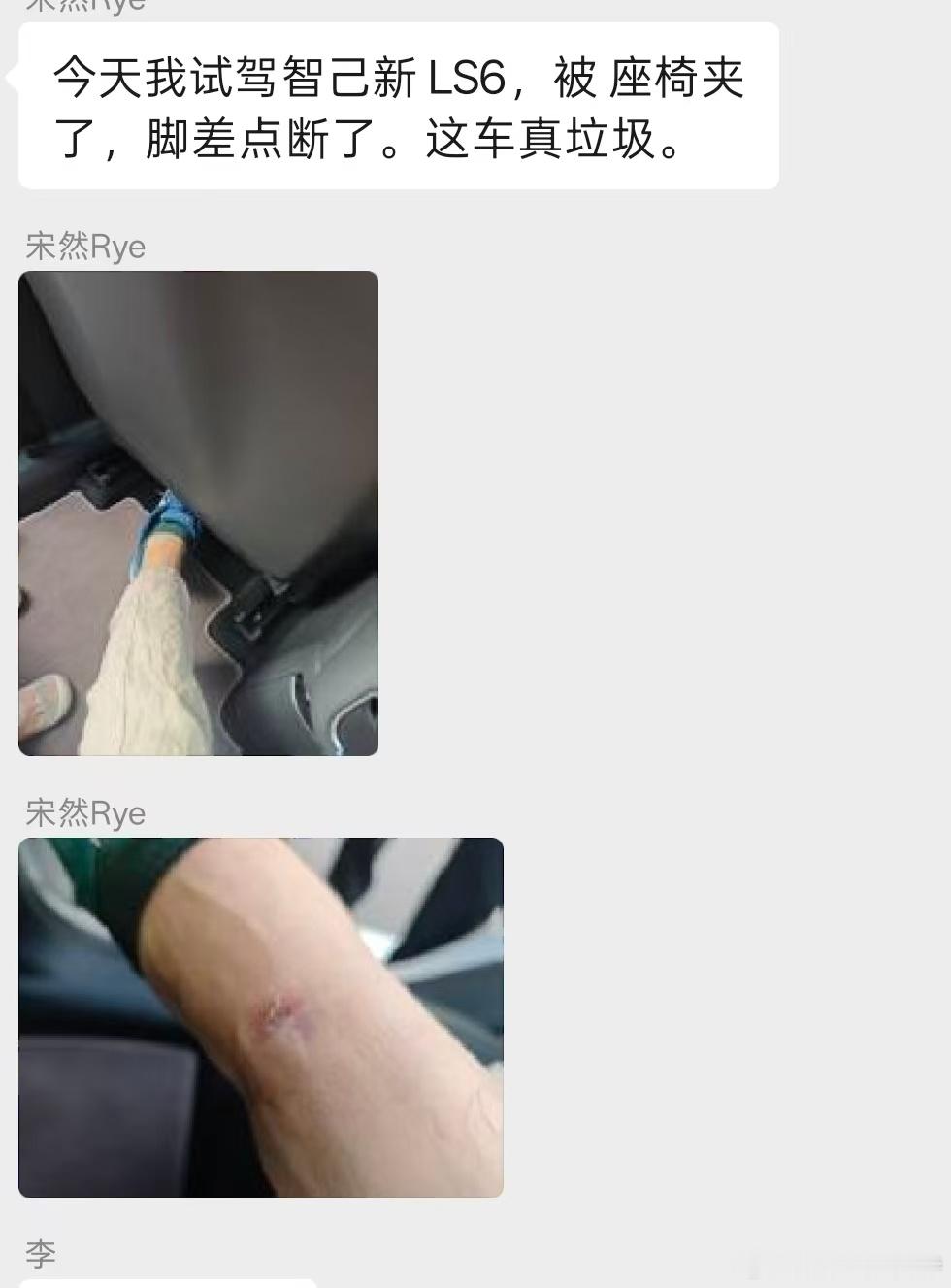 为什么会把腿伸到这个位置？为什么被夹了第一时间拿手机拍照？为什么把照片发友商群里