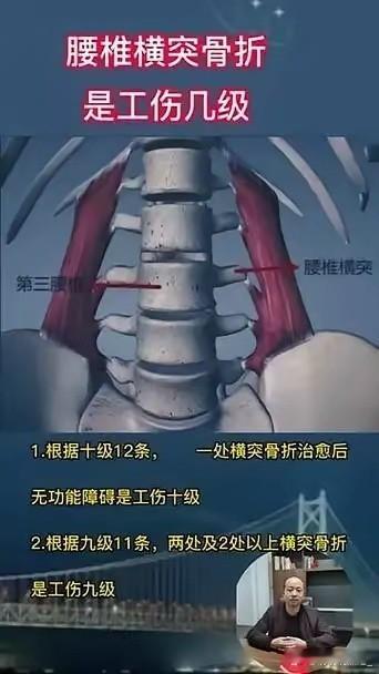 曾凡博的腰椎横突骨折在工伤认定中被归类为十级，这是最轻微的等级，对他的职业生涯影
