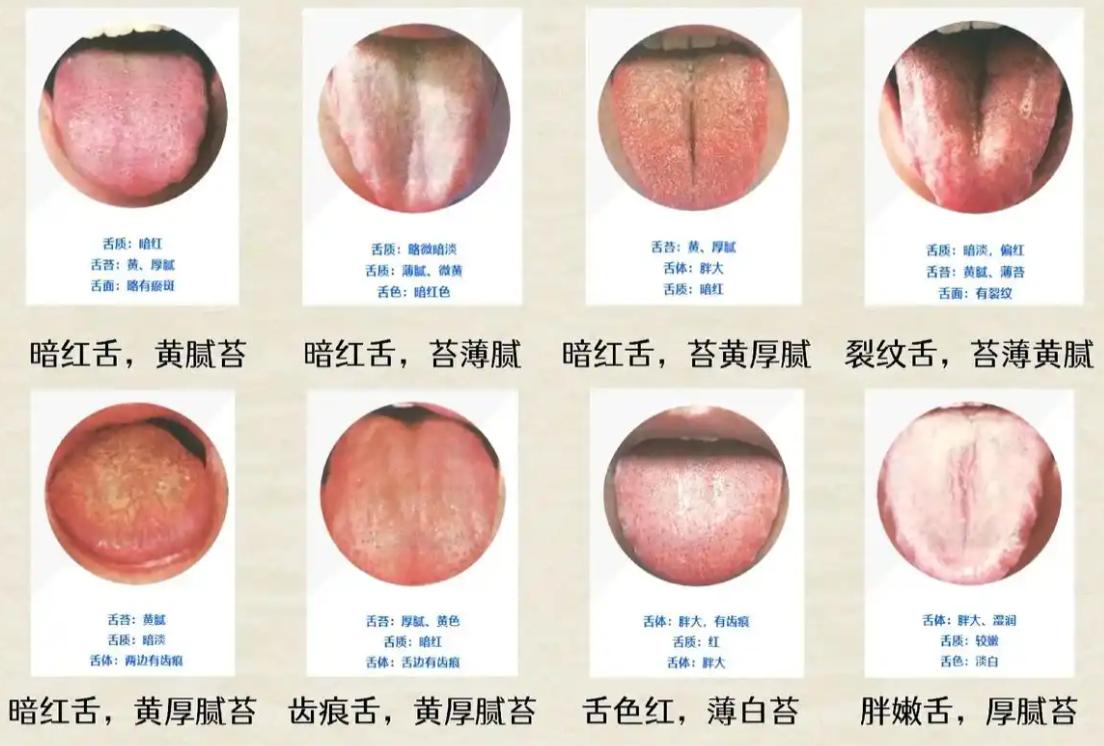 国庆也不停——今天挑战看完88个舌象！

在这金秋十月，我们迎来了祖国的生日。让
