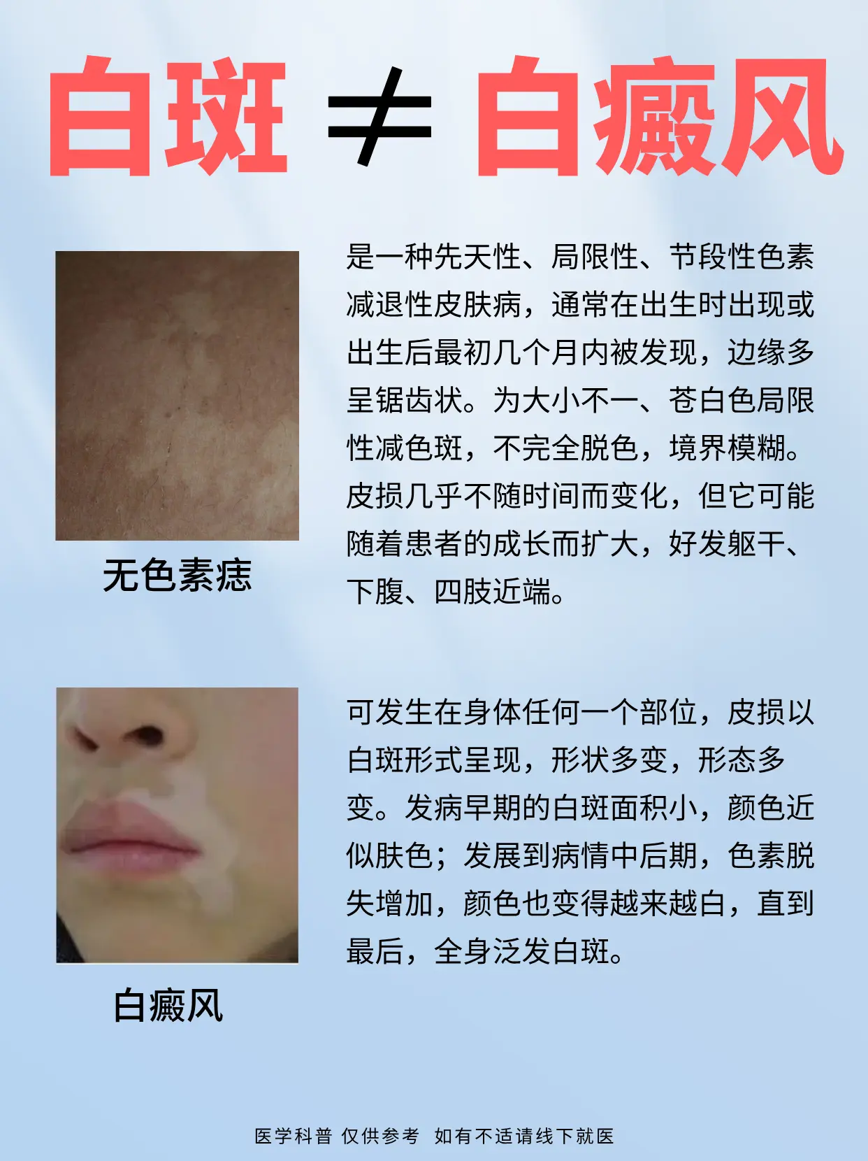 你的白斑是哪种类型？