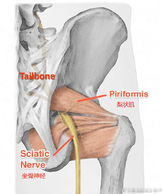梨状肌综合征  腰臀疼痛、腿麻，除了可能是骶髂关节功能障碍和腰突，也可能是梨状肌