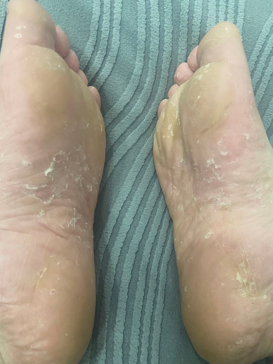 这种到底怎么治啊 ​​​