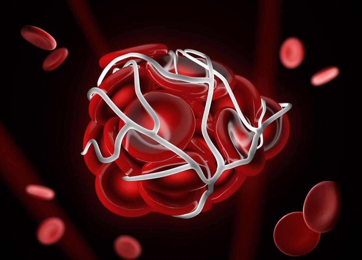 脑梗塞与心肌梗死，是两种非常严重的疾病。虽然分别发生在大脑与心脏，但两者有相同的