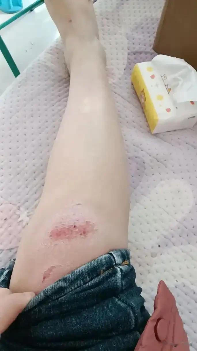 终于明白一道理，为别人着想伤的就是自己。

今天早上我骑自行车去买菜。回来时进小