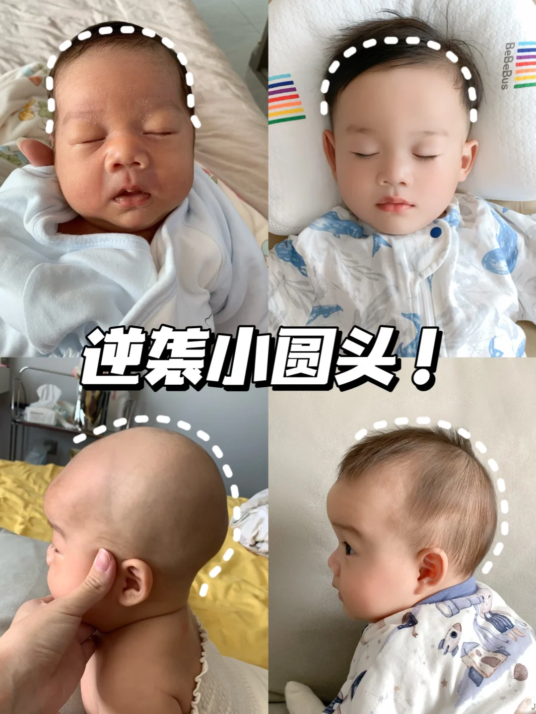 逆袭小圆头！睡圆头成功经验分享！