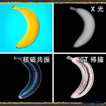 X光、核磁共振、CT的区别。 