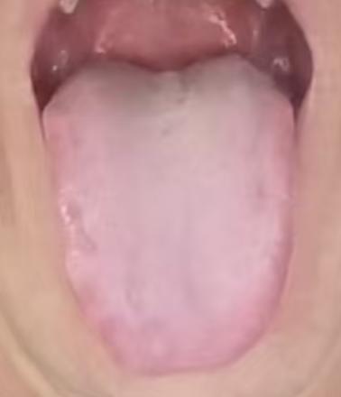 肝肾同调方：疏肝益肾，养筋固本







很多朋友出现了宗筋不振，弱而不起的