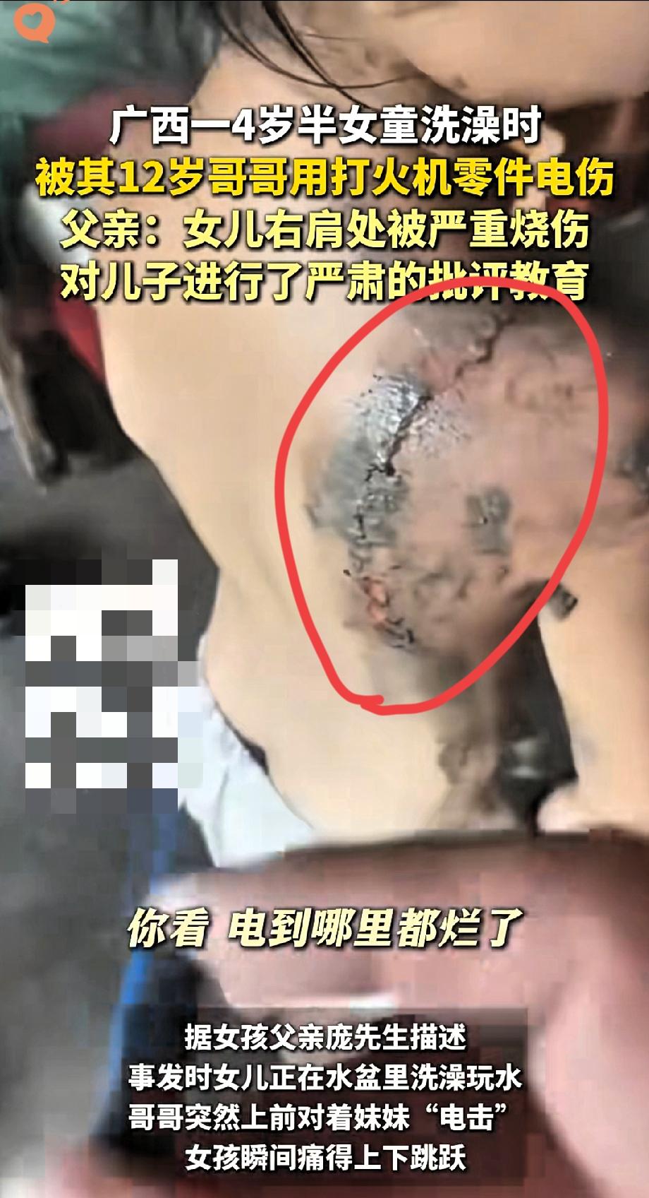 广西4岁女童洗澡遭电击！12岁哥哥恶作剧，家长监护漏洞才是真隐患！
 
家人们看