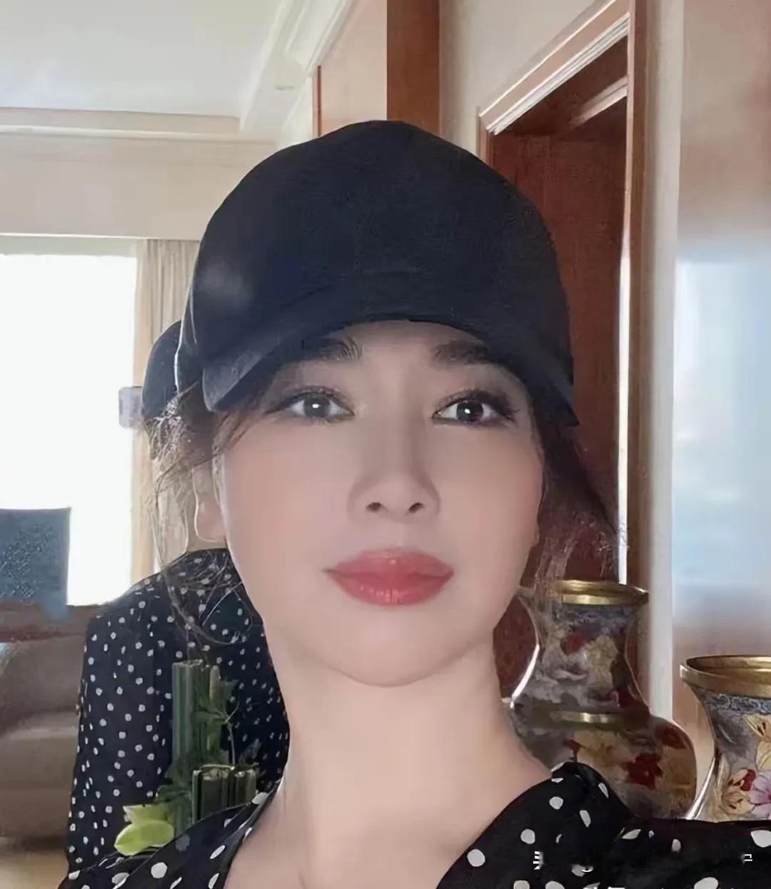这还是左小青吗？简直就是医美版的刘晓庆啊！
