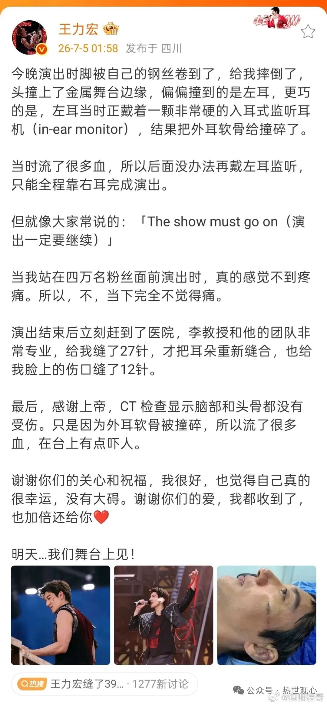 王力宏演唱会【王力宏演唱会意外摔倒，全脸累计缝39针！深夜发文温柔致谢粉丝】摔倒