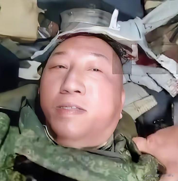 据悉，凤凰卫视卢记者在俄罗斯被乌克兰无人机击中头部受伤。记得上次只是打出了尿，这