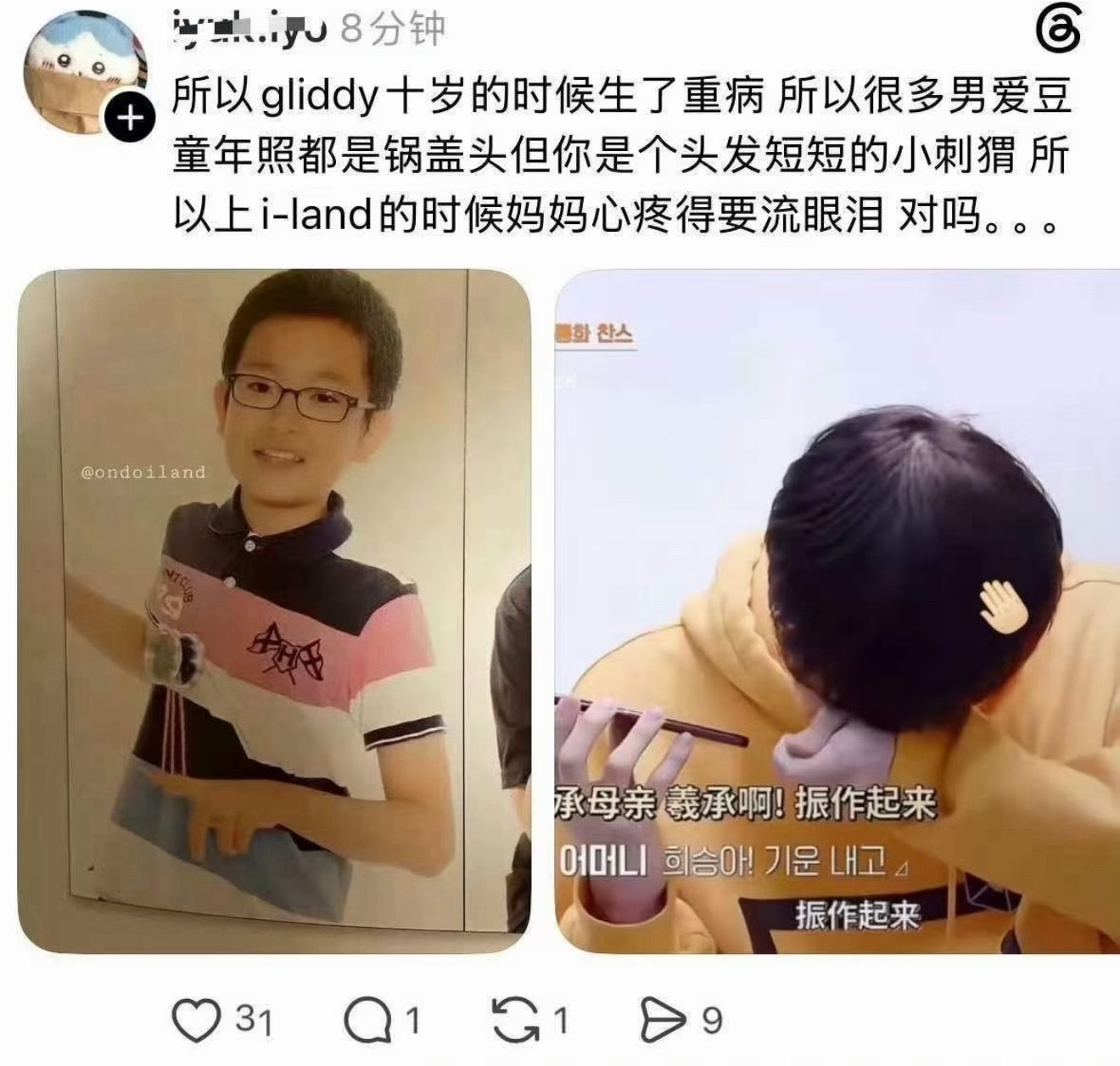 李羲承自曝小时候曾患恶性淋巴癌[傻眼] ​​​