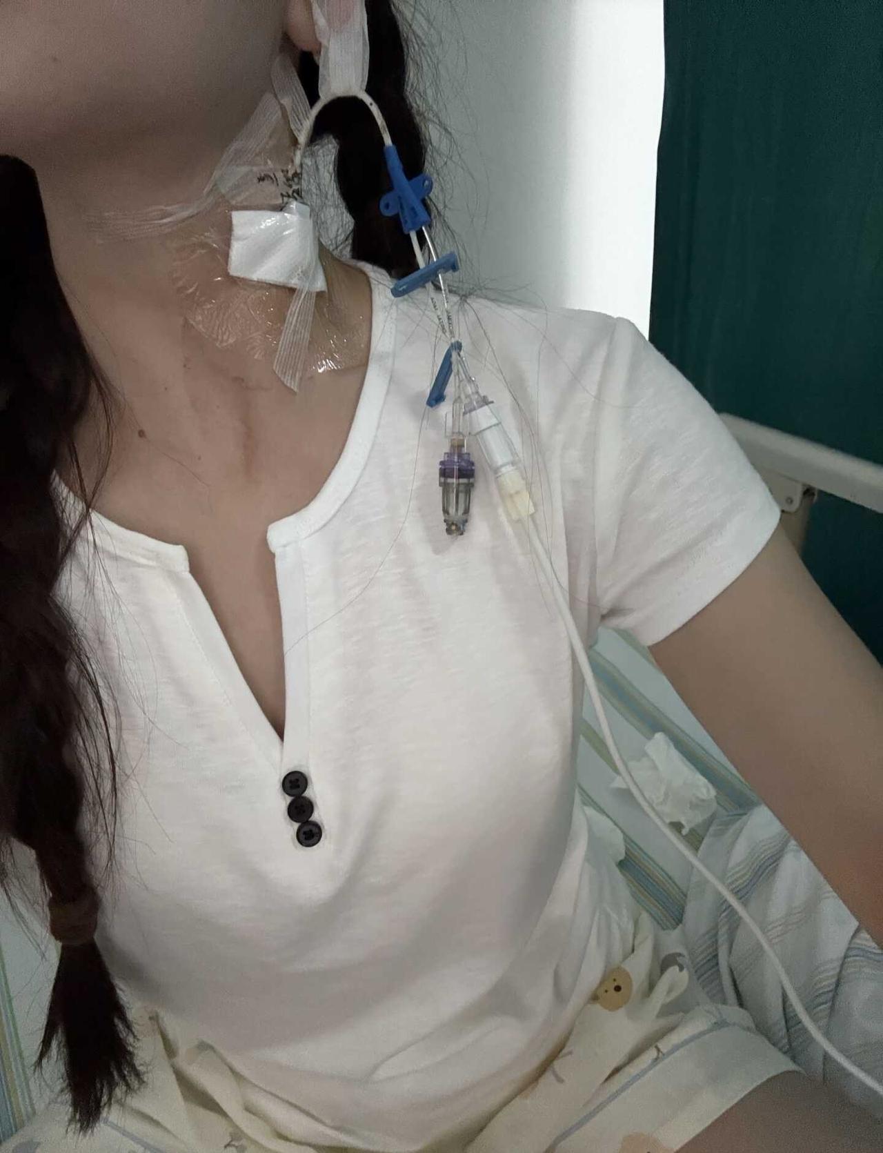 今天是第13天
终于给我拔引流管了  目前吃的就是白粥小米粥面条蒸蛋   但是我