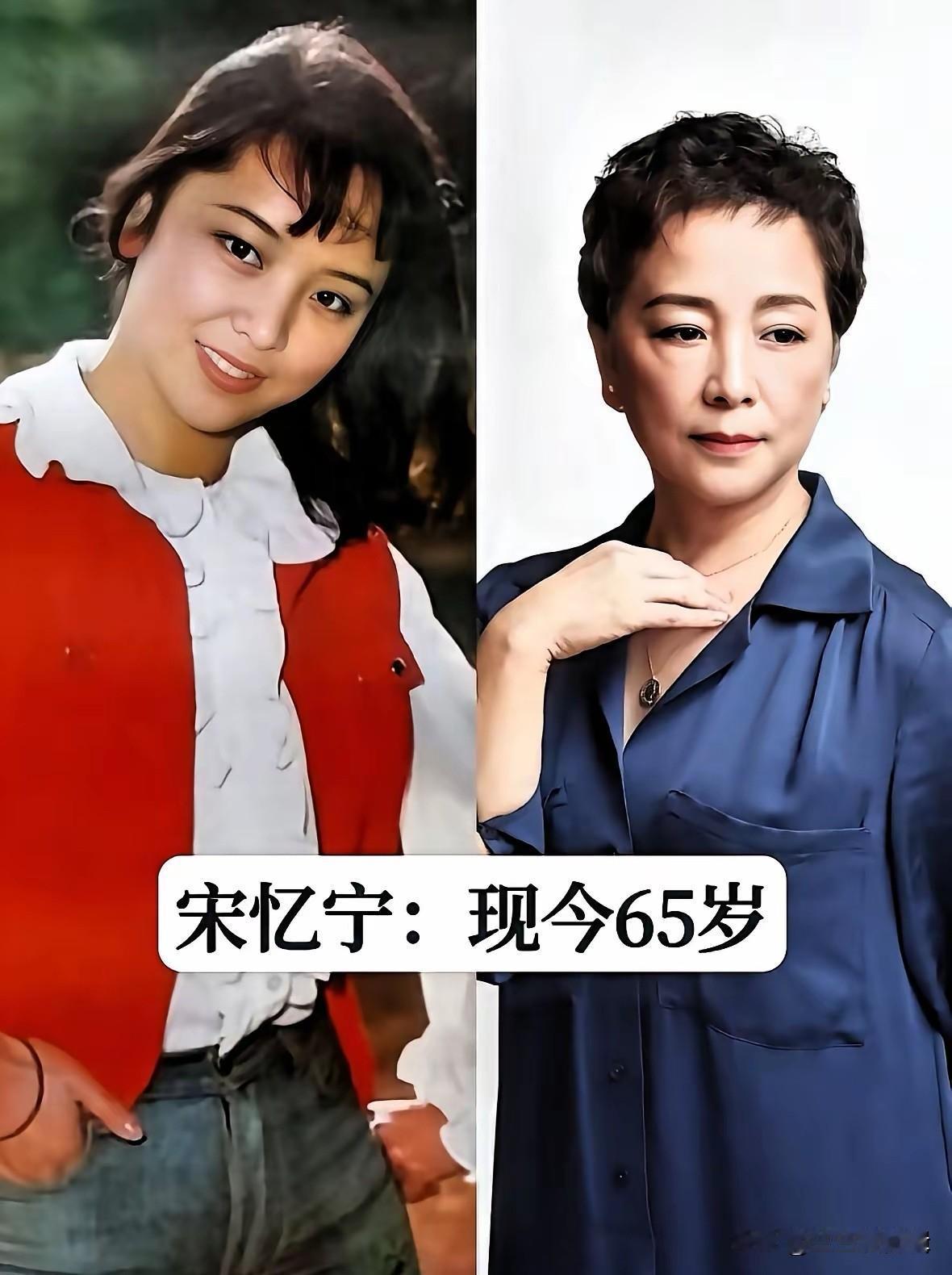12位老戏骨今昔对比，宋忆宁年轻时温婉灵动，年过六十风采依旧。年轻时的她长相秀气