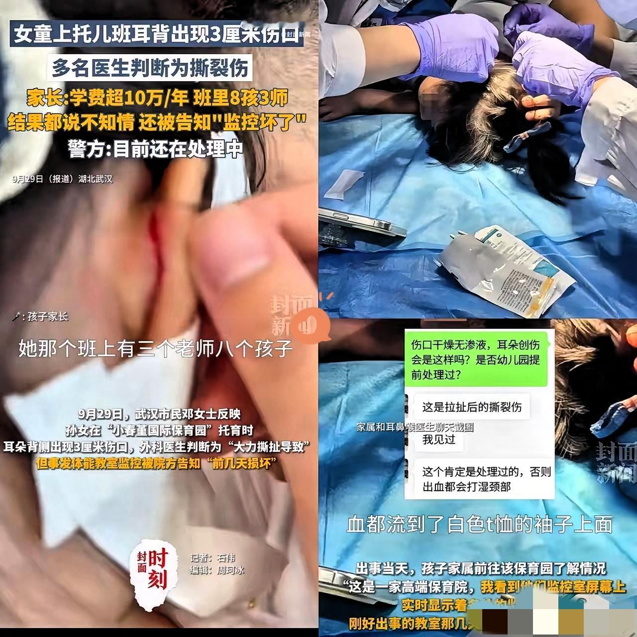 武汉这保育园可算“出名”了，干的缺德事全国都瞅见了，真让人膈应！
 
冯女士家2