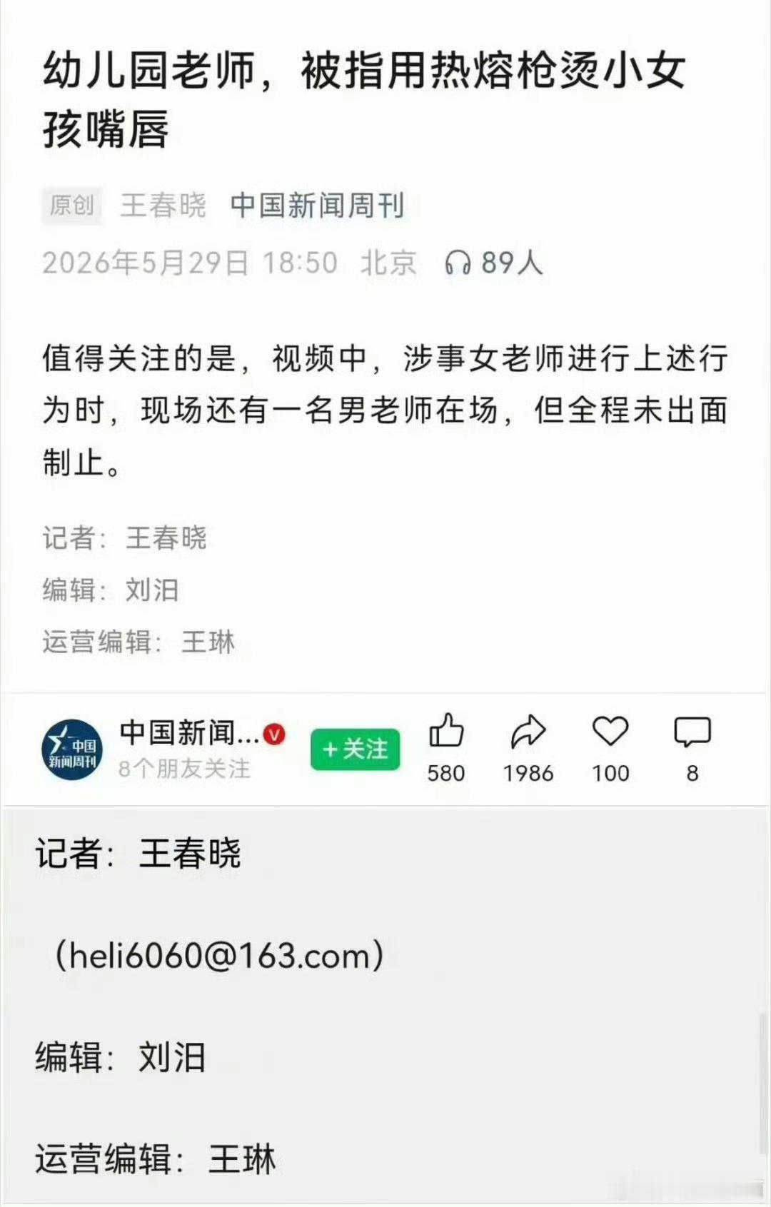 记者报道称，幼儿园老师被指用热熔枪烫小女孩嘴唇，并声称有个男幼师在场没有制止。有