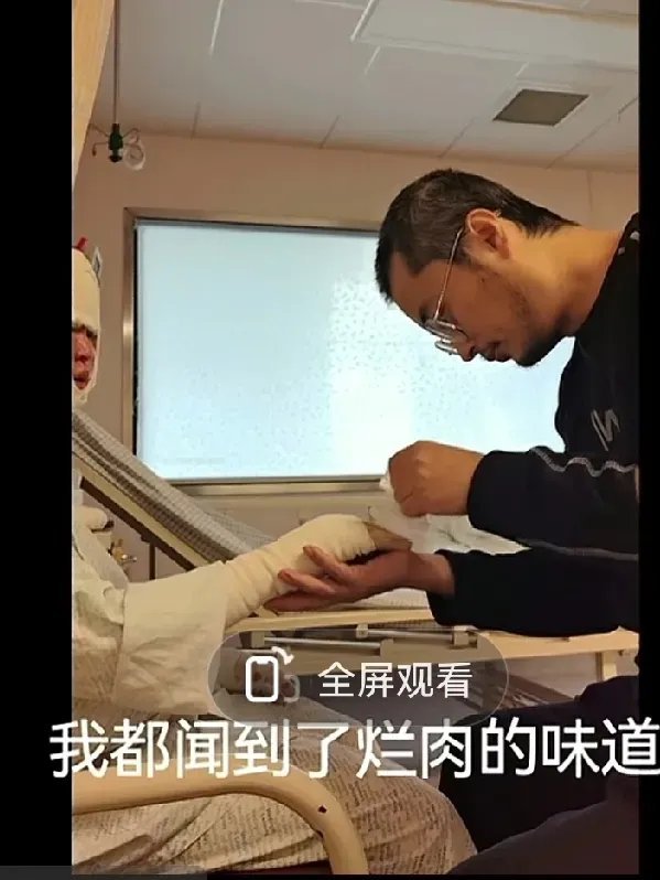 今天烧伤妈妈被评论弄郁闷了，网友说家梅嗲，她说自己说话本来就这样子，很真实也不会