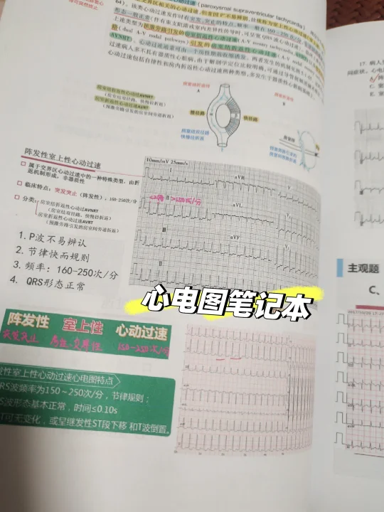 规培值班-心电图实战笔记
