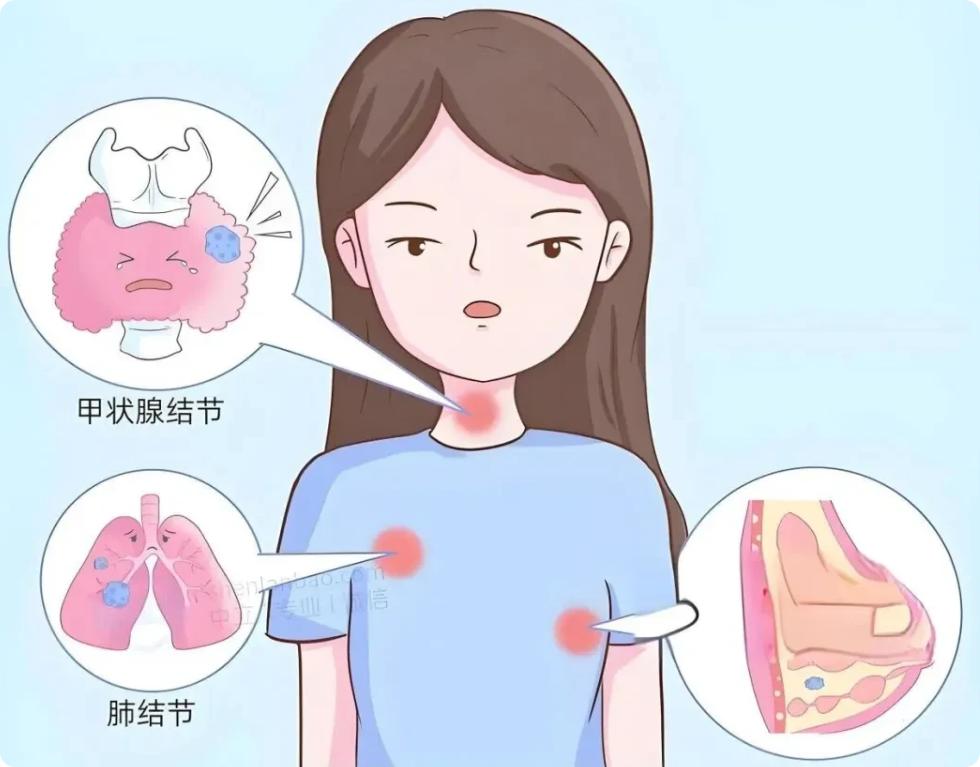 中医大实话：90% 的慢性病、结节、增生，全是「堵」出来的！
大家好，我是陈大夫