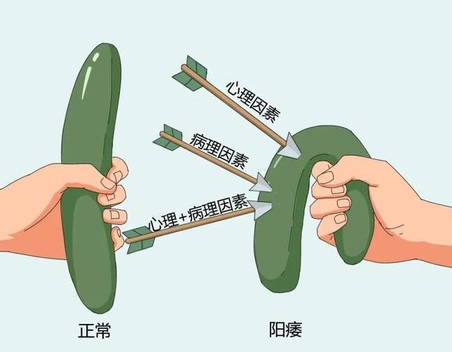 医生科普：次数越多能力越差？ED和次数究竟有无关联？

老王今年45岁，是一家公