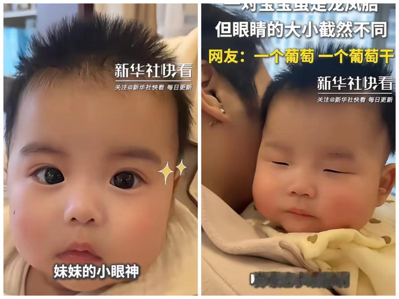 双胞胎兄妹“葡萄眼”与“葡萄干眼”走红：
 
一对双胞胎兄妹因眼睛差异登上热搜，