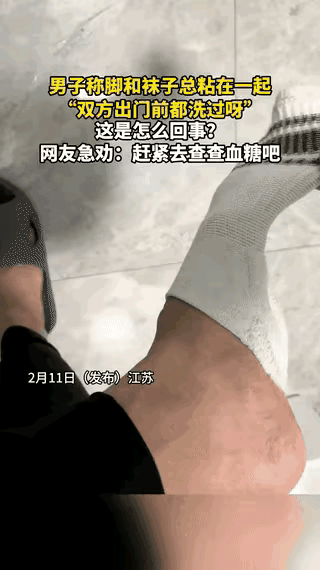 “科学都解释不清了！”江苏，一男子脱袜子时，袜子和脚总是粘在一起，起初，男子还以