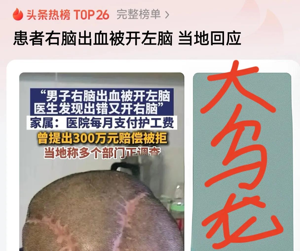 超级大乌龙！患者右脑出血被开左脑，这是有多离谱呀？没有确认环节吗？之后缝合后又开