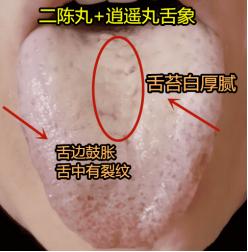 二陈芄这样用，清除身体百分之99的痰湿
 
二陈芄可是健脾胃除痰湿的上上之选，今