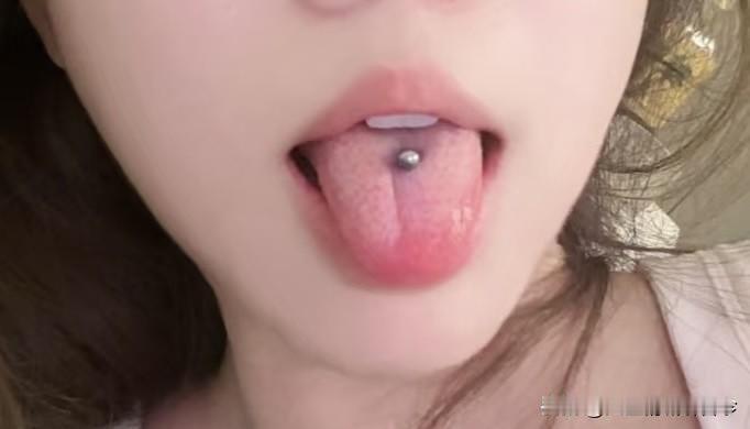 小妹妹才20岁，舌苔看着真不像话，真是让人头皮发麻！

又是寒湿，又是火旺，又是