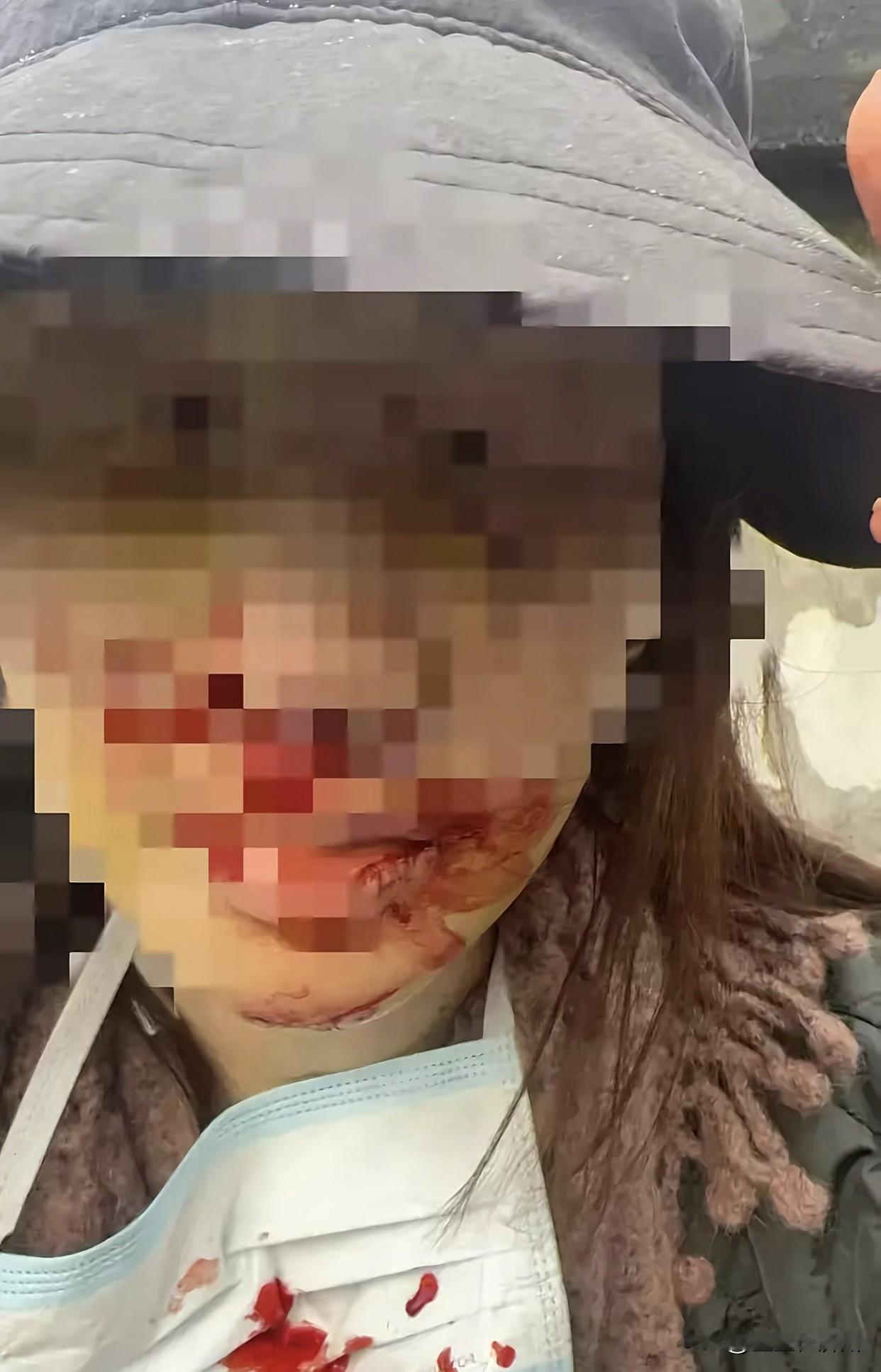 金晨出来道歉了，
并且拿出了一张照片，
很多网友们看完表示冤枉她了……
这张照片