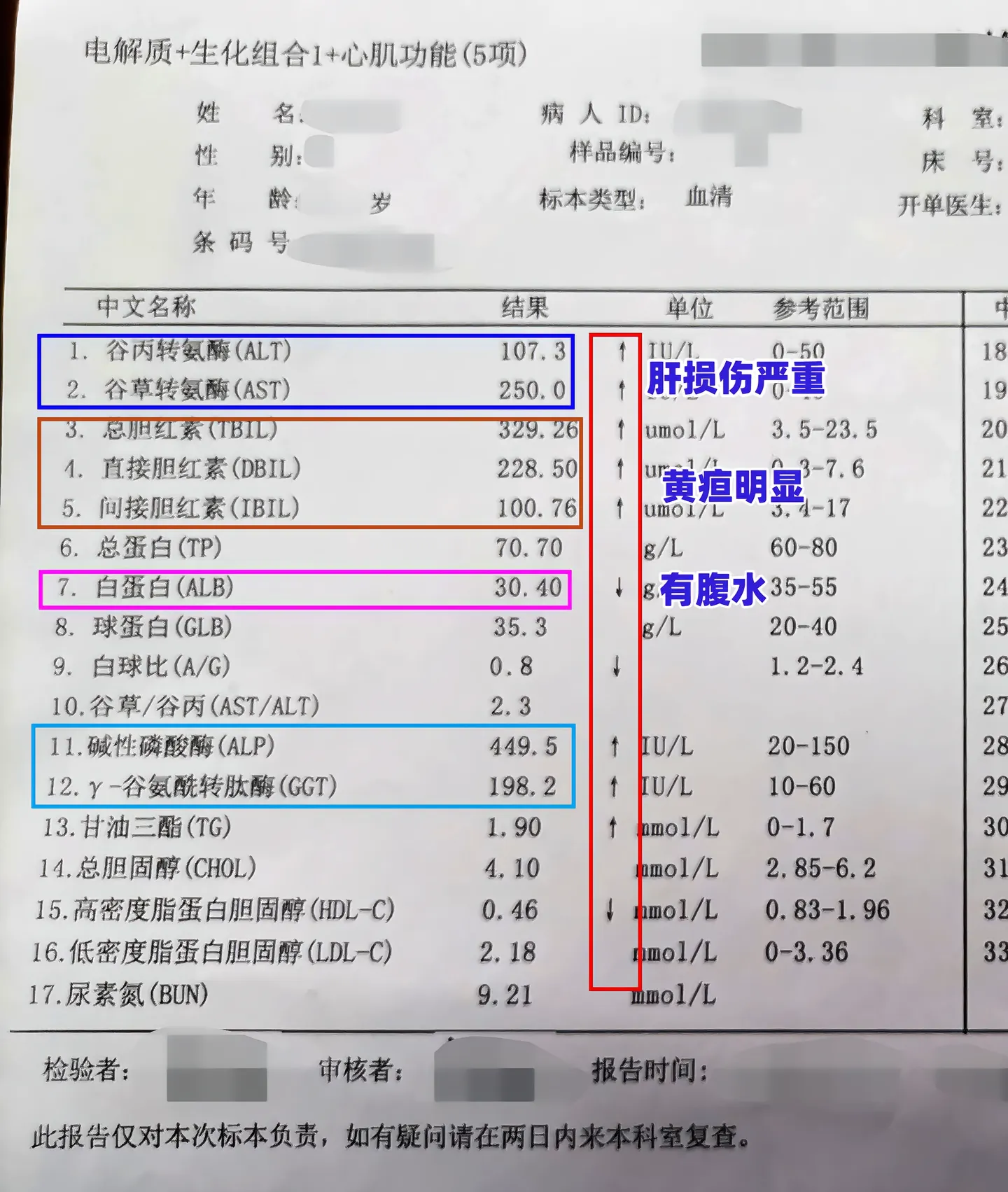 这是一位临沂的乙肝患者的单子，乙肝20余年，有乙肝肝硬化家族史，从来没...