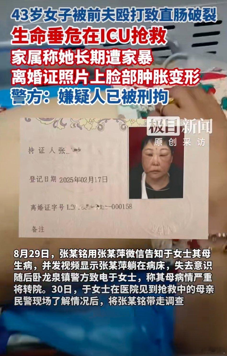 女子遭前夫殴打致肠破裂住进ICU离婚证上都是一脸伤。有的时候，对法律也是挺无奈的