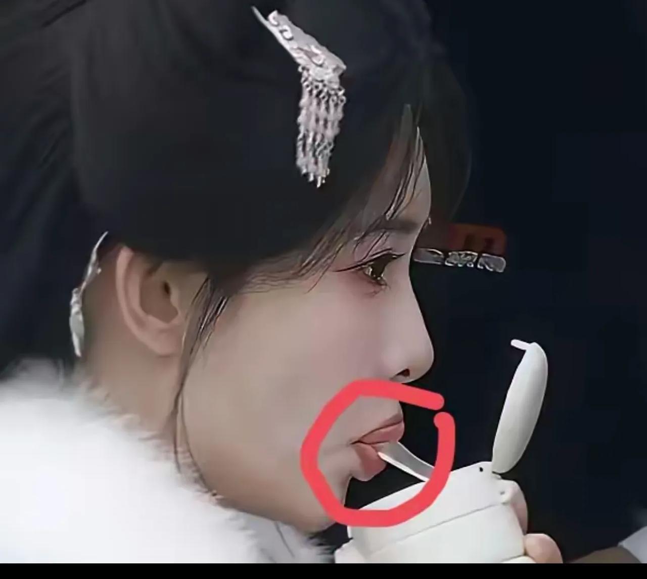 医美要谨慎。这种啵啵唇就不要拍吻戏了。