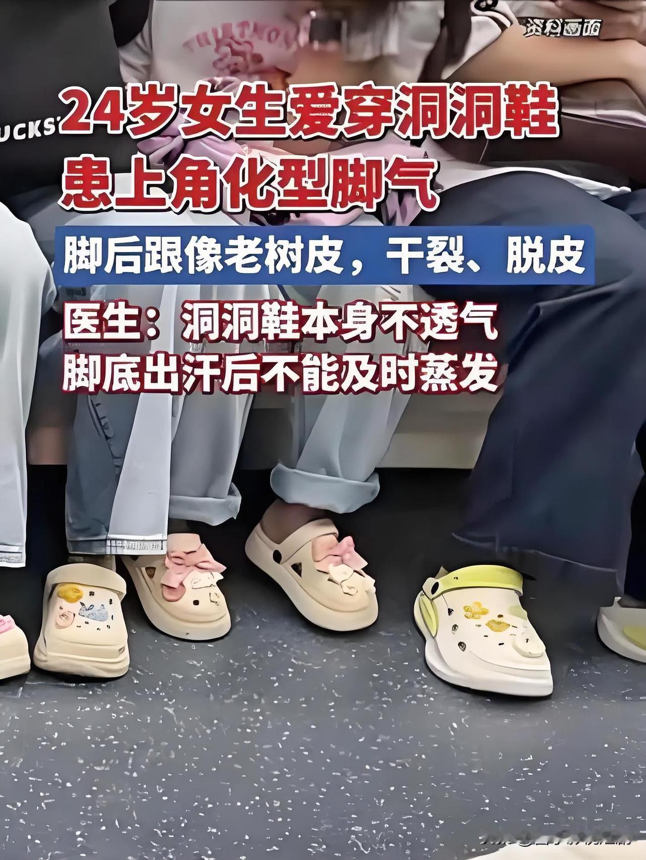 不少人夏天爱光脚穿洞洞鞋出门，医生提醒这一习惯暗藏健康隐患。洞洞鞋材质偏软缺乏足