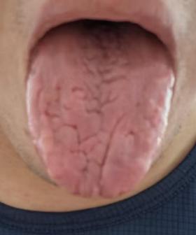 阴虚又伴有湿热该怎么调？清润化湿是关键






有粉丝留言：早年作息不规律，