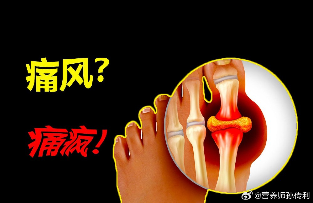 婚前孕前检查真不是走个流程健闻登顶计划 【3个粥方有助于降尿酸】2、车前草粥：利