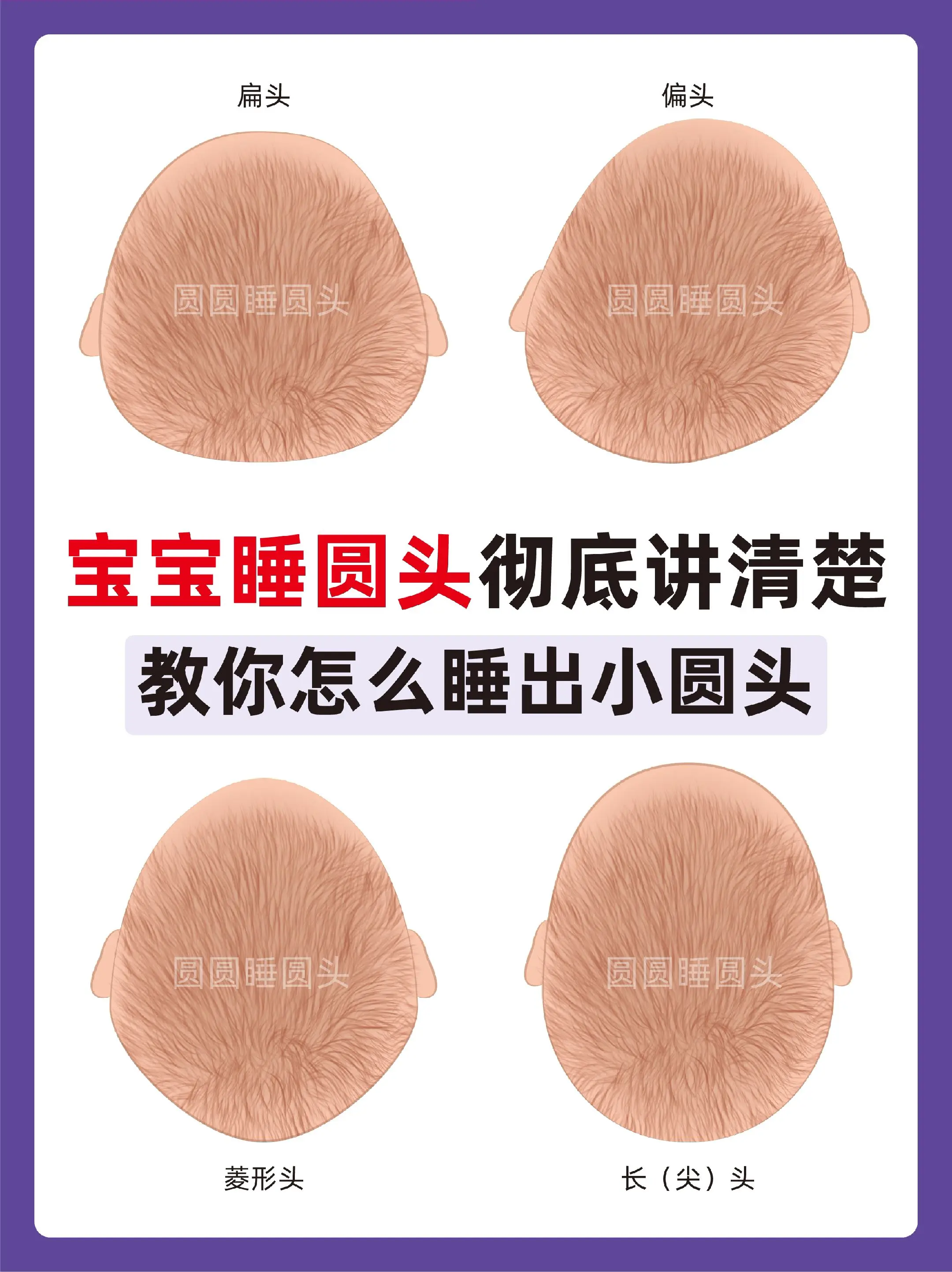 宝宝头型怎么睡✅且效果快。