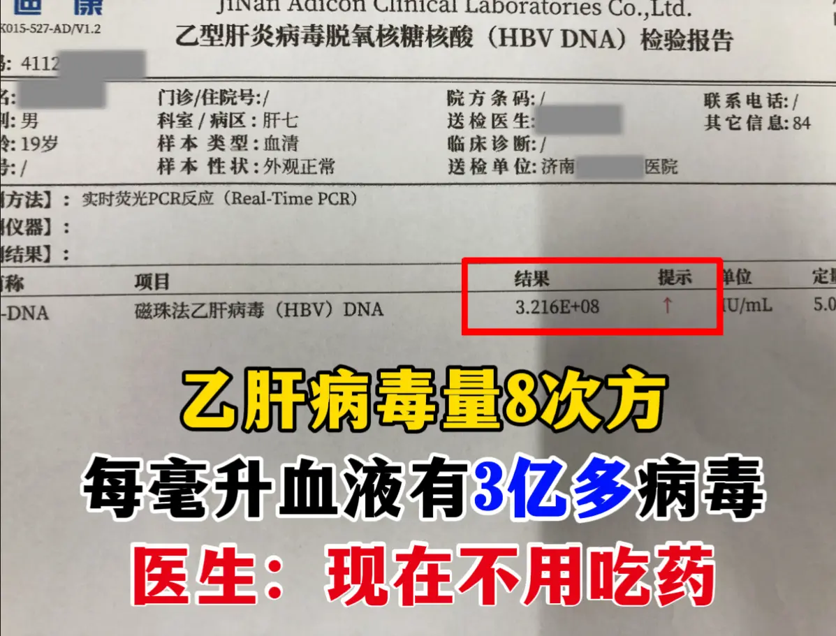 今天门诊来了个济南本地小伙子，才19岁，查出乙肝病毒 8 次方，每毫升...