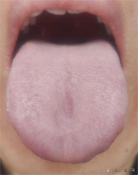 聚会对饮，也不能过量逞能啊，喝的狼狈不堪，最后难受的还是自己[谢谢][谢谢]

