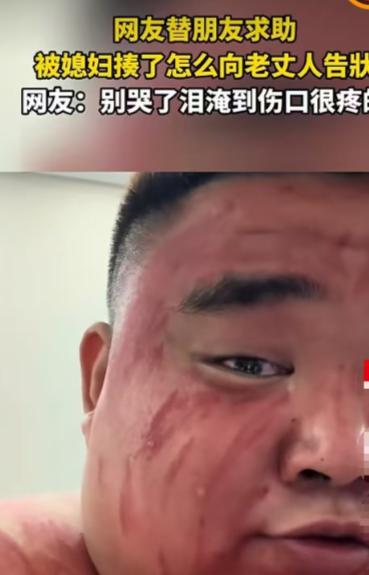 湖北一名男子被媳妇打了，躲到朋友家越想越委屈，决定去找老丈人评理。结果他在朋友家